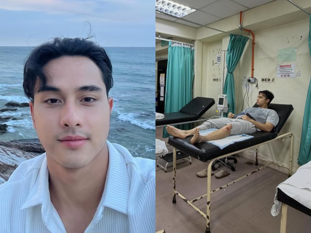 Aniq Suhair cedera ketika penggambaran filem, terima 6 jahitan di lutut