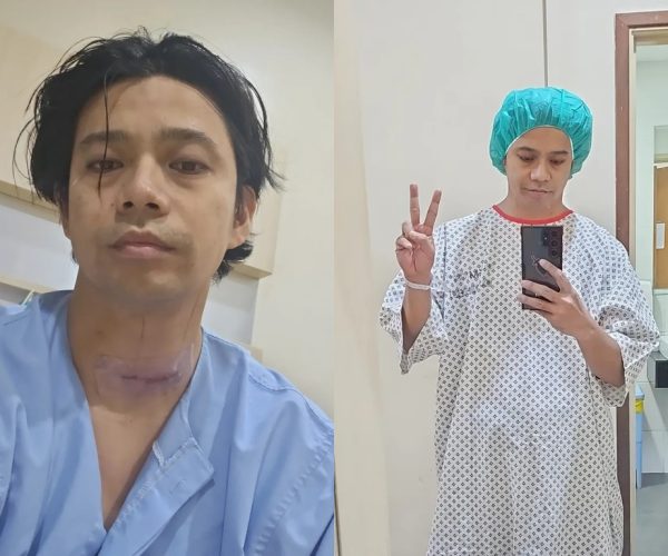 Noh Salleh selamat jalani pembedahan berisiko tinggi