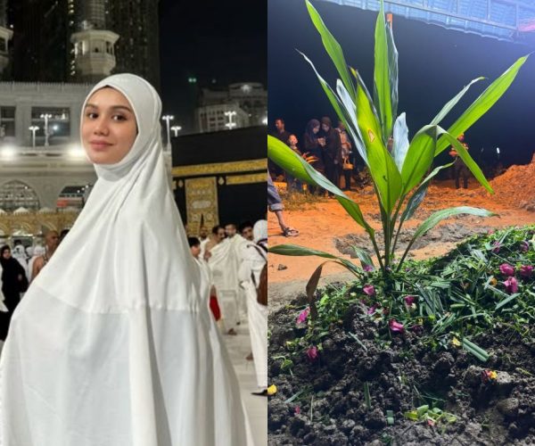 Abang Mimi Lana meninggal dunia