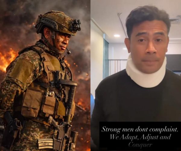 Remy Ishak alami kemalangan ketika penggambaran filem