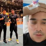 Mata cedera terkena bola, Aaron Aziz mohon maaf tak dapat penuhi tuntutan kerja