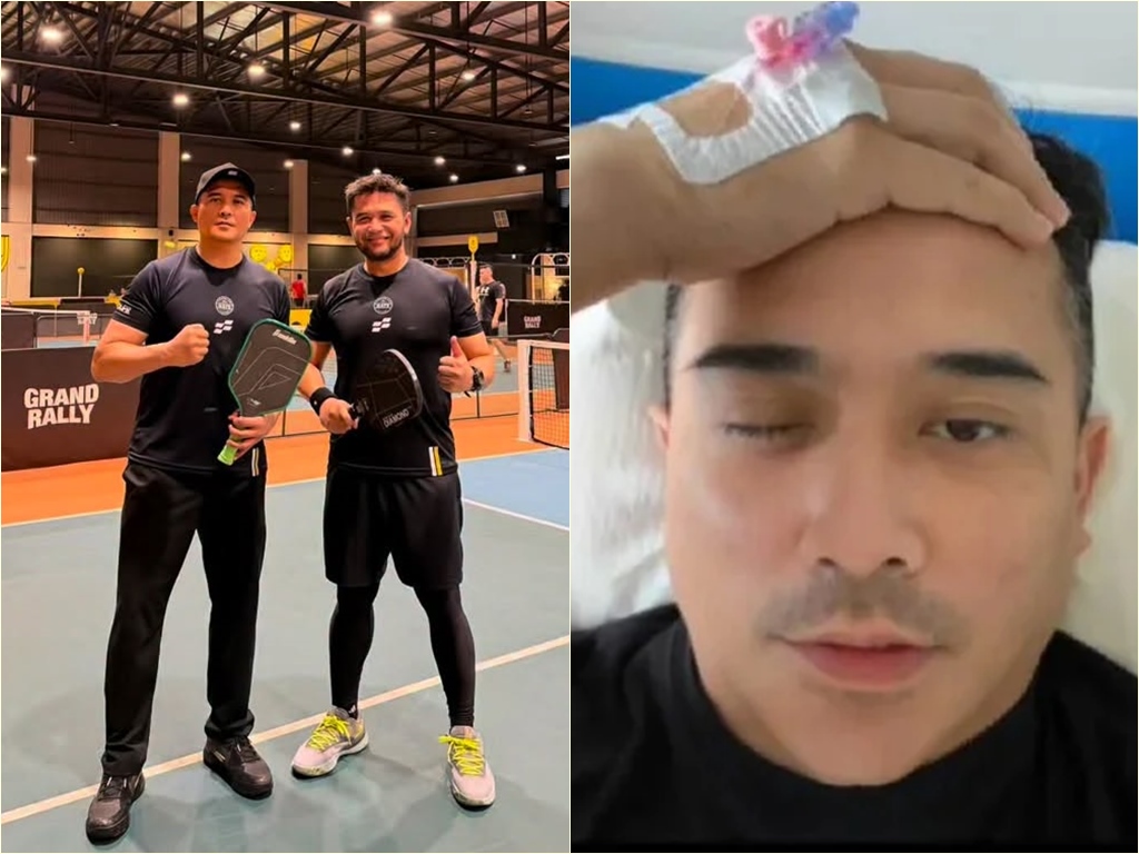 Mata cedera terkena bola, Aaron Aziz mohon maaf tak dapat penuhi tuntutan kerja