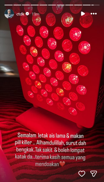 "Alhamdulillah, bengkak dah surut" – Siti Nurhaliza beri perkembangan selepas kemalangan, biduanita negara, penyanyi, selebriti, siti nurhaliza, MissMynah