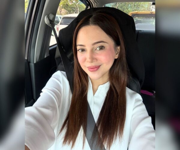 Wajah bengkak akibat psoriasis, Sharmaine Alexander bidas dakwaan suntik filler