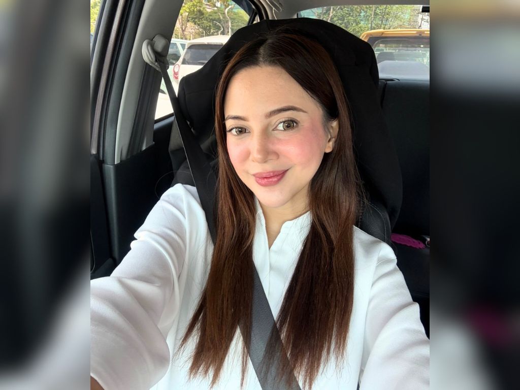 Wajah bengkak akibat psoriasis, Sharmaine Alexander bidas dakwaan suntik filler
